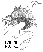 ��������Ĥ����խ