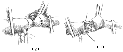 ��������������խ