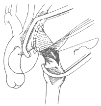 ��������������խ