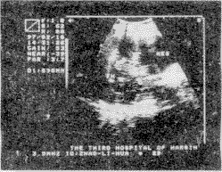 2601.gif (14599 bytes)