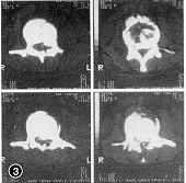 03.gif (10214 bytes)