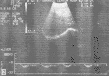 77-2.gif (7207 bytes)