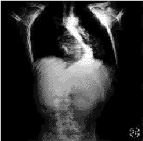 26703.gif (6163 �ֽ�)