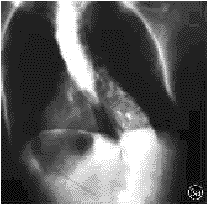 26705.gif (7797 �ֽ�)