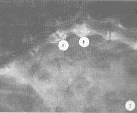 t50-2.gif (12740 �ֽ�)