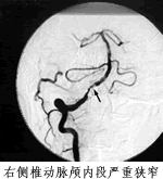 �ҹ���Ѫ�ܲ���������ȡ����ͻ�ƣ���֧����ͨ׵���׶�����ɹ�//