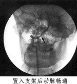 �ҹ���Ѫ�ܲ���������ȡ����ͻ�ƣ���֧����ͨ׵���׶�����ɹ�//