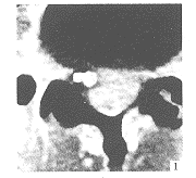 ��������γɵ��񾭸��׿�2��