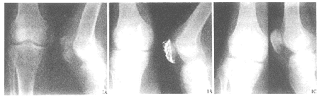 �������������ڹ̶������ƹǷ����Թ���