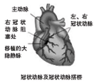 心脏的营养血管――冠状动脉