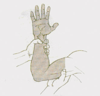 Ժ�⼱�ȣ�ֹѪ����һ��