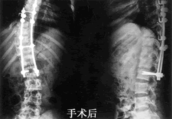 �����Ρ���ͦ������