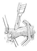 ��������֢