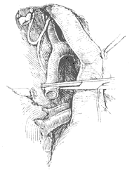 ��������֢