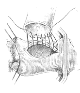 ��������֢