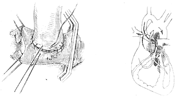 ��������֢