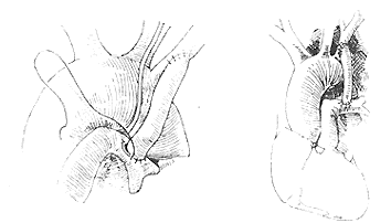 ��������֢