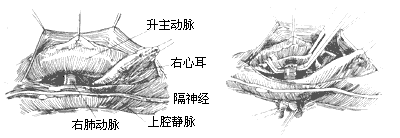 ��������֢