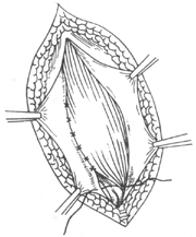 ���ɹ�б��