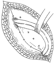 ���ɹ�б��